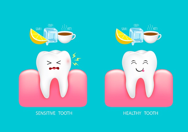 Teeth Hypersensitivity